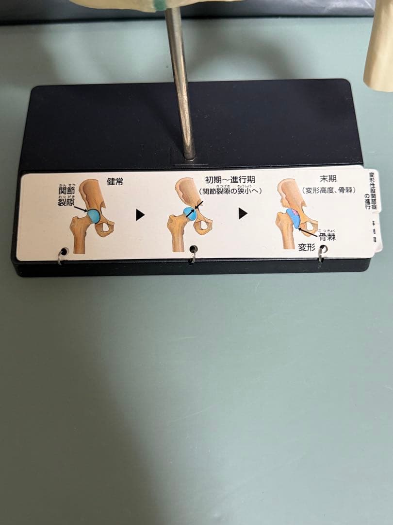 Voltaren 骨盤模型 大腿骨付き腰椎 脊髄 骨格模型　骨模型 人体模型