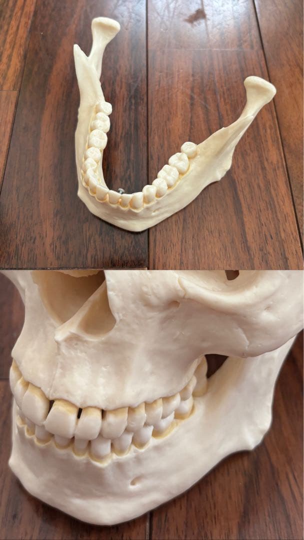 [SOMSO]頭蓋骨模型　【厳重包装】