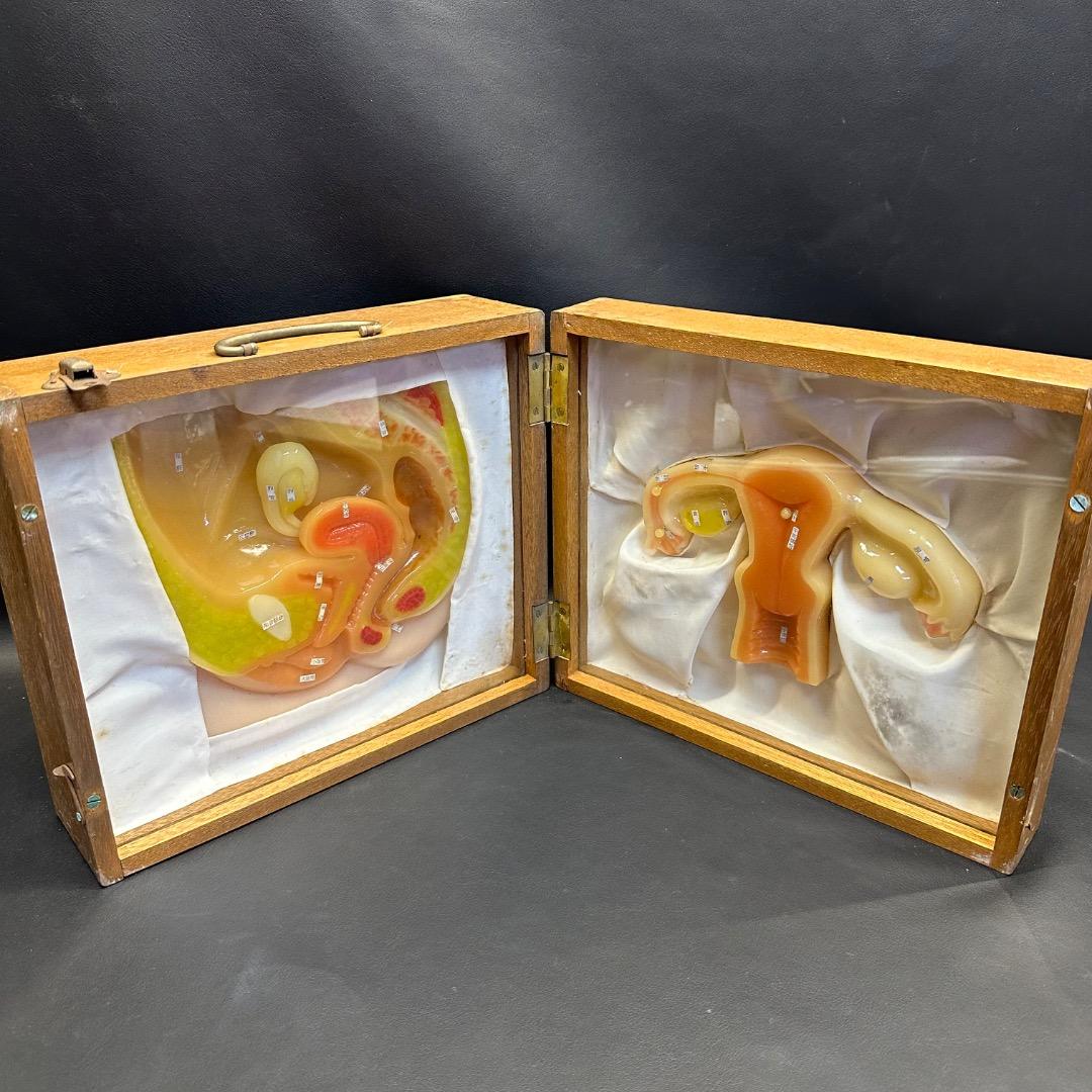 ♡Fc右1008 子宮模型 医療用 断面図 子宮 木製ケース入り 昭和レトロ
