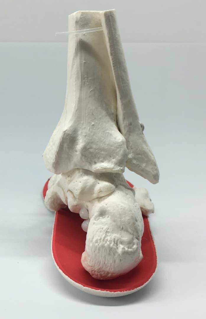 SK8INSOLL® DOUBLE AXEL カスタマイズインソール サイズXS