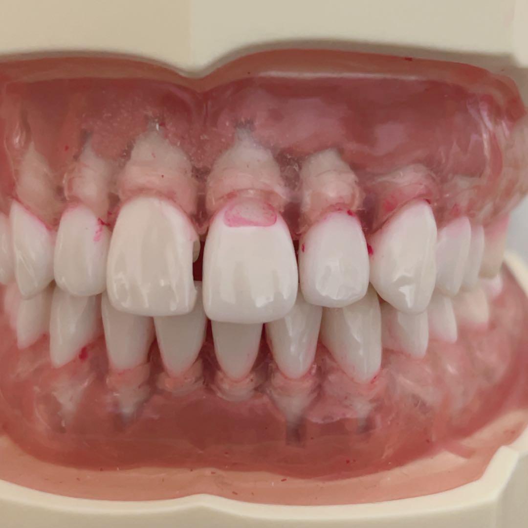 NISSIN 顎模型 歯科衛生士 歯科医師 歯科