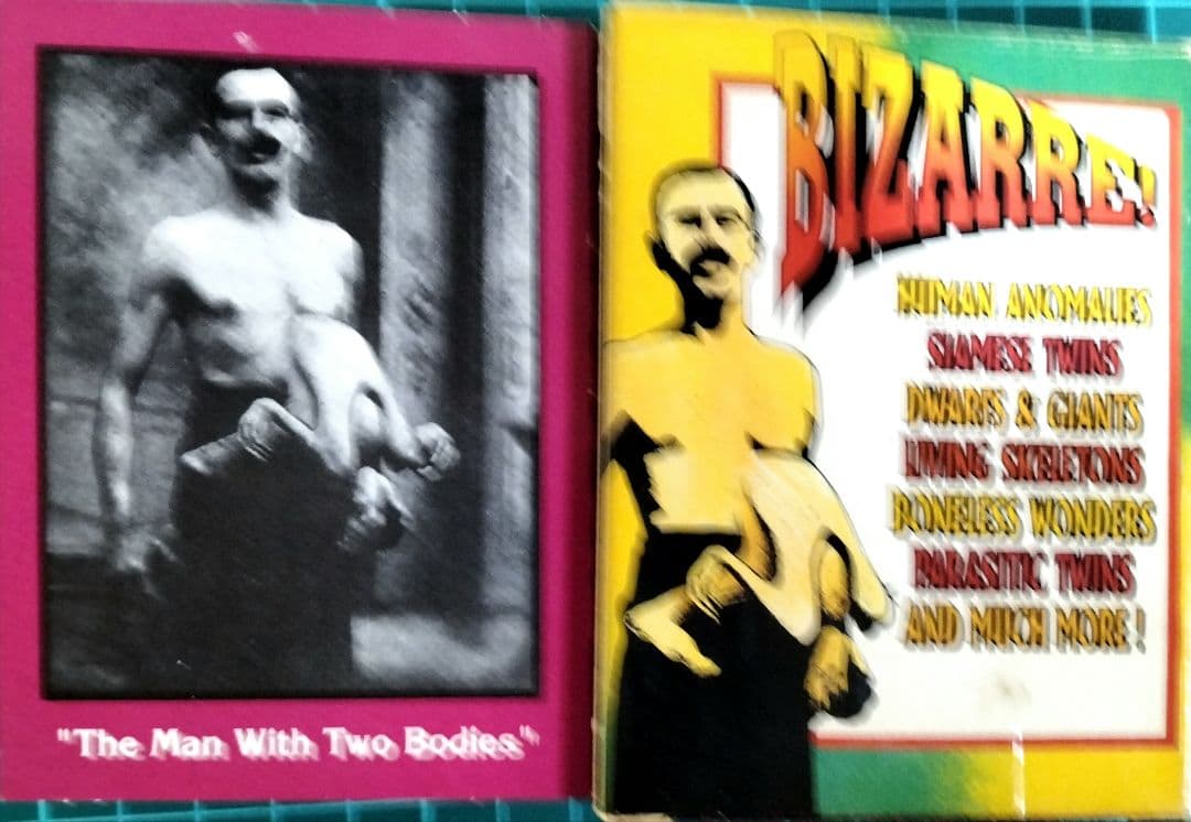 フリークスカード　畸形　見世物小屋　異端　米国製　『希少品』