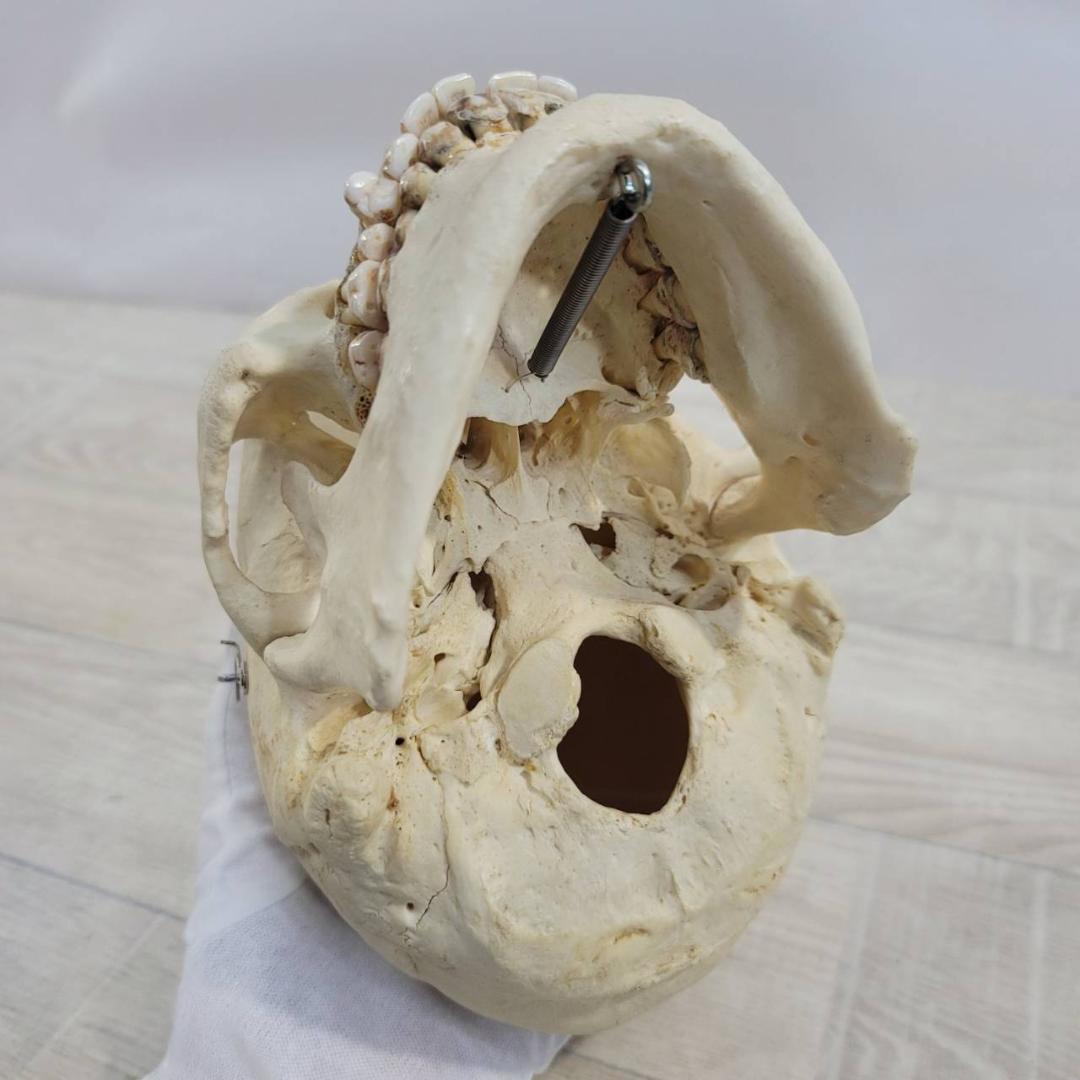 頭蓋骨 頭骨 骨格標本 人体模型 医療 医学 人類学 民俗学 アンティーク 呪物