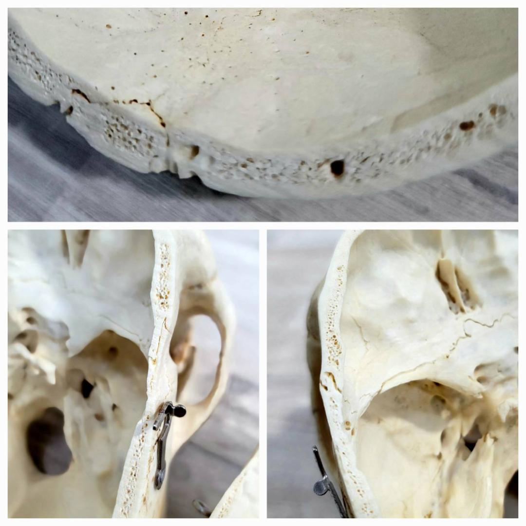 頭蓋骨 頭骨 骨格標本 人体模型 医療 医学 人類学 民俗学 アンティーク 呪物