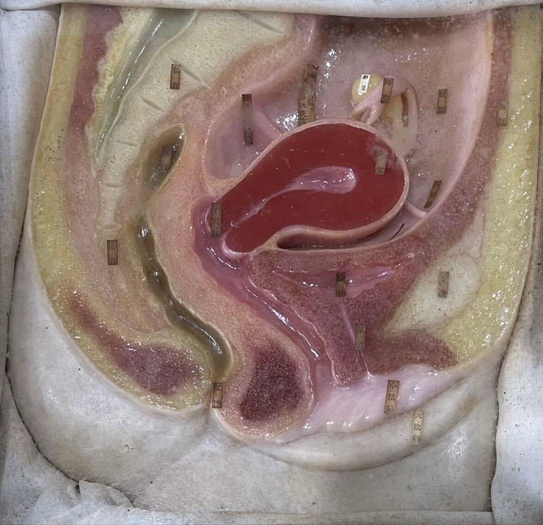 1、医療用 模型 子宮 解剖学的女性生殖器模型 木製ケース入り 送料込みで発送